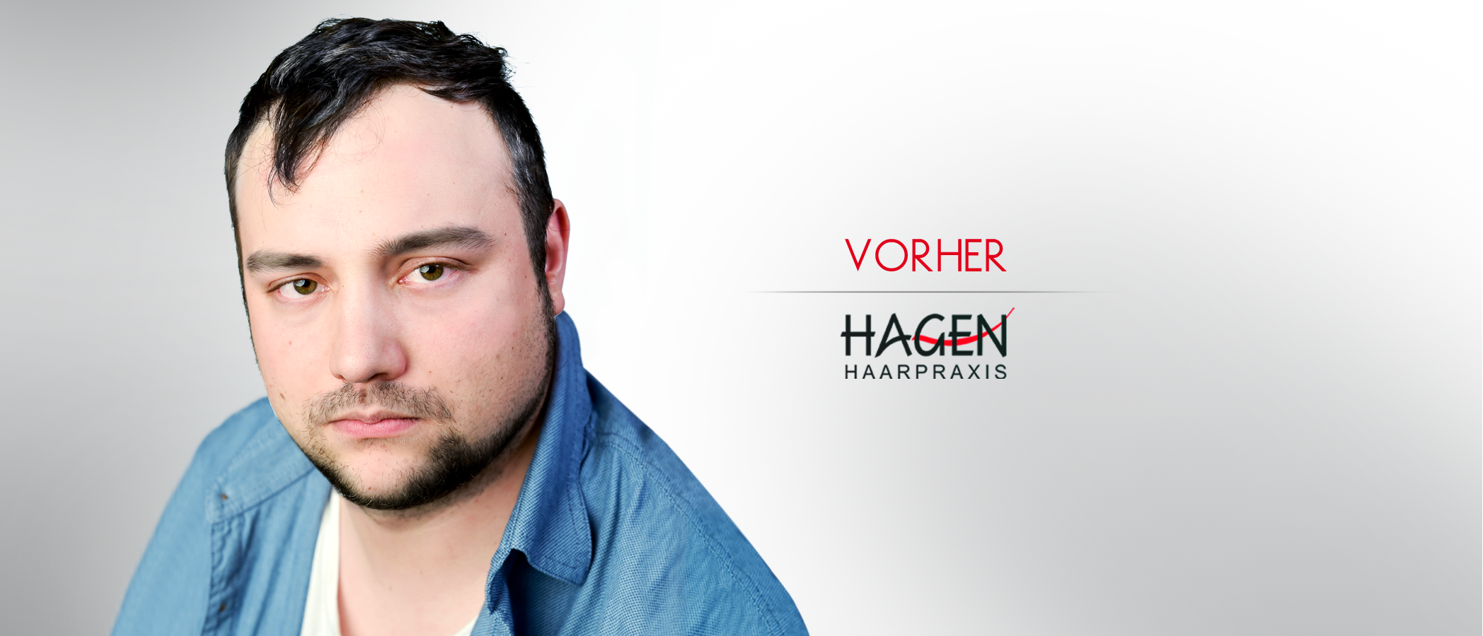 vorher_slider